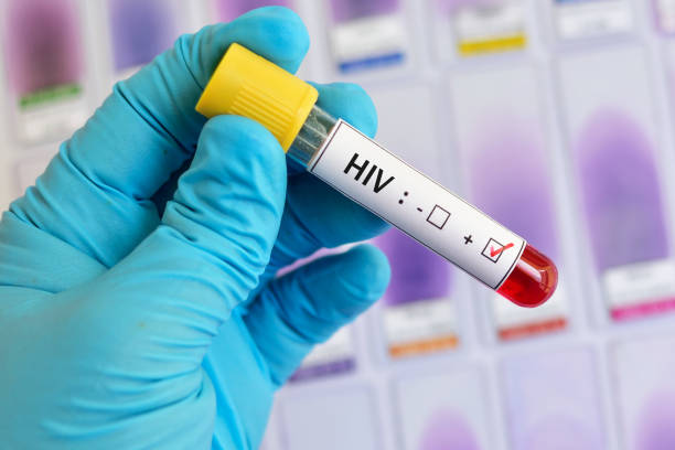 李炜、Robert Siliciano团队获得消灭潜伏HIV病毒的新药物靶点和药物组合