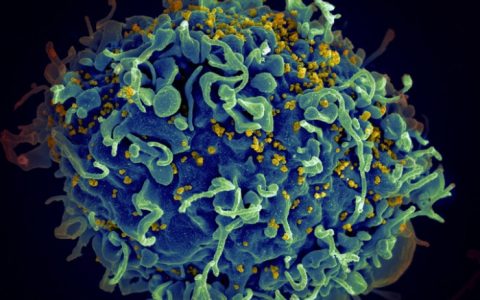 研究人员在艾滋(HIV)疫苗中发现了强烈的T细胞反应