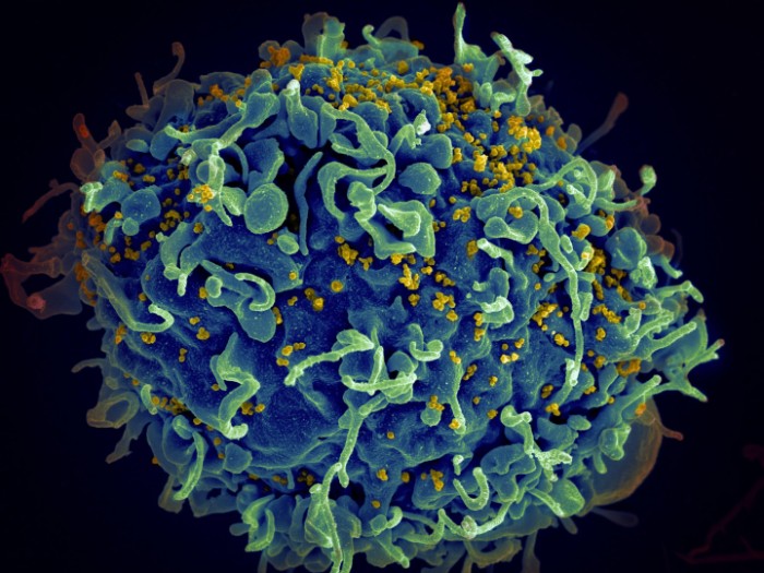 研究人员在艾滋(HIV)疫苗中发现了强烈的T细胞反应