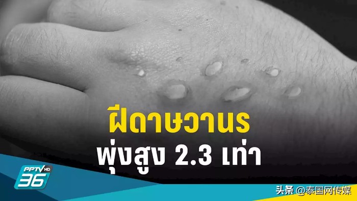 骄傲月后泰国猴痘患者激增至近百例！多数为男同群体！